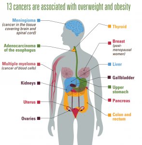 cancer and obesity
